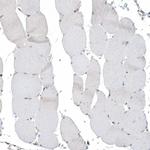 PSD4 Antibody in Immunohistochemistry (IHC)