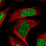 KHSRP Antibody in Immunocytochemistry (ICC/IF)