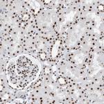 KHSRP Antibody in Immunohistochemistry (Paraffin) (IHC (P))