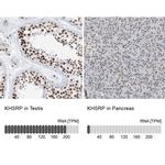 KHSRP Antibody in Immunohistochemistry (IHC)