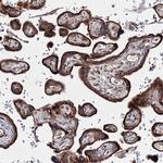 GFM1 Antibody in Immunohistochemistry (IHC)