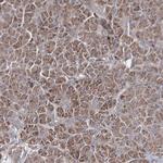 GFM1 Antibody in Immunohistochemistry (IHC)