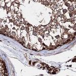 GFM1 Antibody in Immunohistochemistry (IHC)