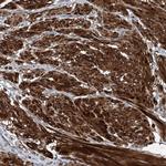 DGUOK Antibody in Immunohistochemistry (Paraffin) (IHC (P))