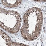 DGUOK Antibody in Immunohistochemistry (Paraffin) (IHC (P))