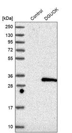 DGUOK Antibody in Western Blot (WB)