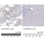 CACNA2D2 Antibody in Immunohistochemistry (IHC)