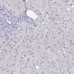 CACNA2D2 Antibody in Immunohistochemistry (IHC)