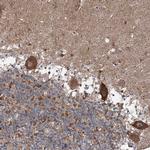 JIP2 Antibody in Immunohistochemistry (Paraffin) (IHC (P))