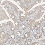 LIPT1 Antibody in Immunohistochemistry (Paraffin) (IHC (P))