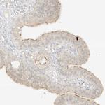 LIPT1 Antibody in Immunohistochemistry (Paraffin) (IHC (P))