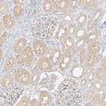 LIPT1 Antibody in Immunohistochemistry (Paraffin) (IHC (P))