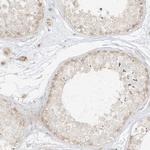 LIPT1 Antibody in Immunohistochemistry (Paraffin) (IHC (P))