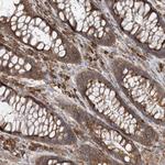 ACAP2 Antibody in Immunohistochemistry (Paraffin) (IHC (P))