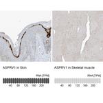 ASPRV1 Antibody in Immunohistochemistry (IHC)