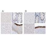 ASPRV1 Antibody in Immunohistochemistry (IHC)