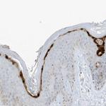 ASPRV1 Antibody in Immunohistochemistry (IHC)