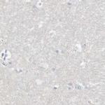 ASPRV1 Antibody in Immunohistochemistry (IHC)