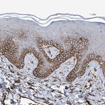 UBTD1 Antibody in Immunohistochemistry (IHC)