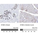 SF3B14 Antibody in Immunohistochemistry (IHC)