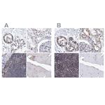 SF3B14 Antibody in Immunohistochemistry (IHC)