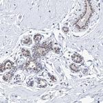 SF3B14 Antibody in Immunohistochemistry (IHC)