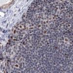 SF3B14 Antibody in Immunohistochemistry (IHC)