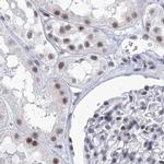 SF3B14 Antibody in Immunohistochemistry (IHC)