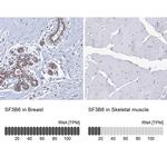 SF3B14 Antibody in Immunohistochemistry (IHC)