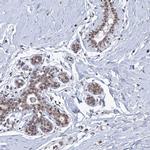 SF3B14 Antibody in Immunohistochemistry (IHC)