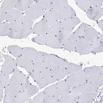 SF3B14 Antibody in Immunohistochemistry (IHC)