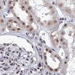 SF3B14 Antibody in Immunohistochemistry (IHC)