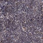 SF3B14 Antibody in Immunohistochemistry (IHC)