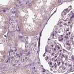 Opticin Antibody in Immunohistochemistry (IHC)