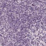 Opticin Antibody in Immunohistochemistry (IHC)