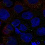 SLC6A12 Antibody in Immunocytochemistry (ICC/IF)