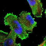 XRN1 Antibody in Immunocytochemistry (ICC/IF)