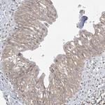 XRN1 Antibody in Immunohistochemistry (IHC)