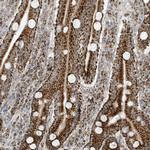 ATP5I Antibody in Immunohistochemistry (Paraffin) (IHC (P))