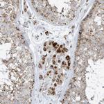 ATP5I Antibody in Immunohistochemistry (Paraffin) (IHC (P))