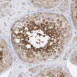 KIAA1310 Antibody in Immunohistochemistry (Paraffin) (IHC (P))