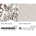 Grancalcin Antibody in Immunohistochemistry (IHC)