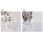 Grancalcin Antibody in Immunohistochemistry (IHC)