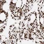 Grancalcin Antibody in Immunohistochemistry (IHC)