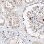 Grancalcin Antibody in Immunohistochemistry (IHC)