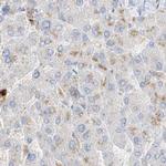 Grancalcin Antibody in Immunohistochemistry (IHC)