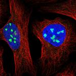 MPP10 Antibody in Immunocytochemistry (ICC/IF)