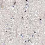 MPP10 Antibody in Immunohistochemistry (IHC)