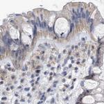 MPP10 Antibody in Immunohistochemistry (IHC)