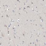 MPP10 Antibody in Immunohistochemistry (IHC)